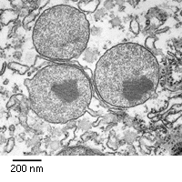 Peroxisoma