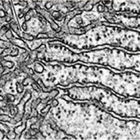 Ret&iacute;culo Endoplasm&aacute;tico